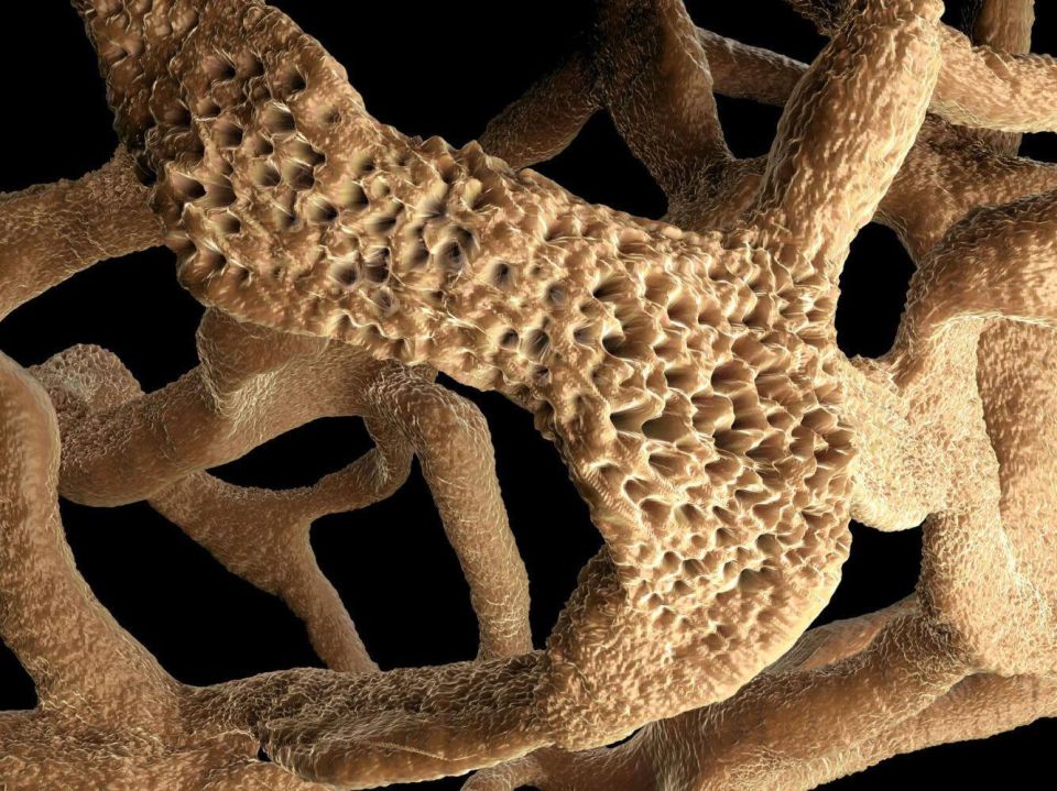 20 октября отмечают Всемирный день борьбы с остеопорозом