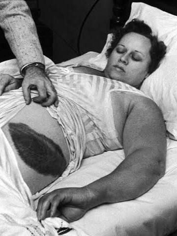 Энн Элизабет Ходжес — первый и единственный человек, в которого попал метеорит