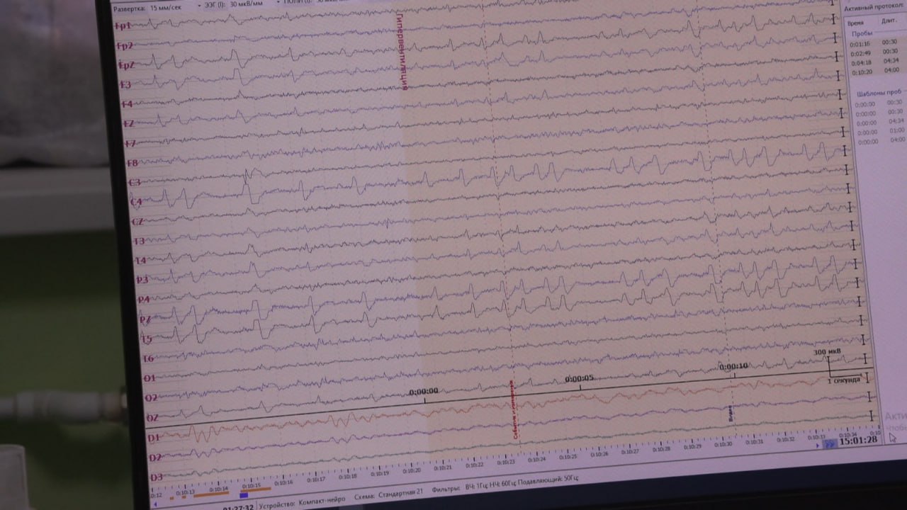 В бендерском Центре матери и ребёнка появился новый видео-энцефалограф В бендерском Центре матери и ребёнка появился новый видео-энцефалограф