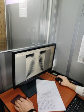 Завтра выездной флюорограф приедет в Бендеры