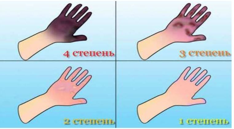 ������� ����������� ���. �������� ��������, ��� �� ����������� ���������� �������-���������������� ���������� ����������, �� ���� 2 ������� � ������������ ���������� �� ��������� �������� � �������������