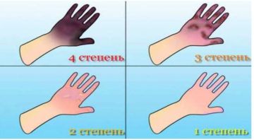 ������� ����������� ���. �������� ��������, ��� �� ����������� ���������� �������-���������������� ���������� ����������, �� ���� 2 ������� � ������������ ���������� �� ��������� �������� � �������������