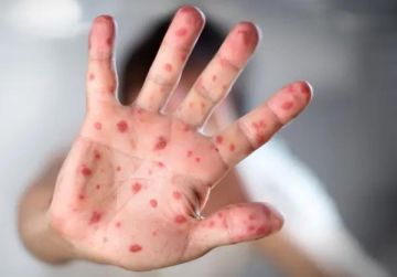 ��� ������ ���� ���������������� � �������� � ������ ���� - ���� � ������, ��� � �������