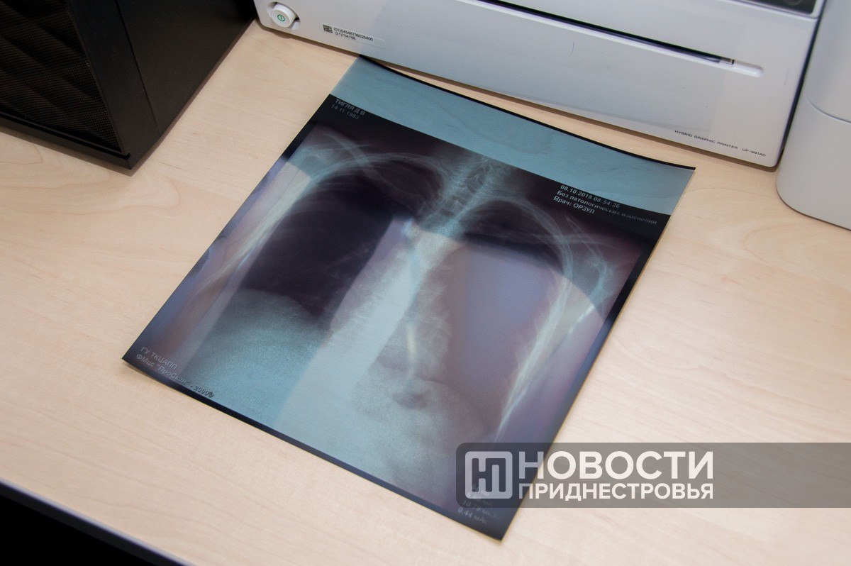 Бесплатно пройти флюорографию могут жители Бендер, Гиски и Протягайловки до конца этой недели