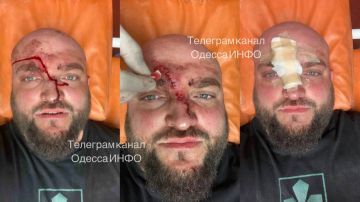 В Затоке мужчина арматурой избил военного из-за замечаний о русской музыке