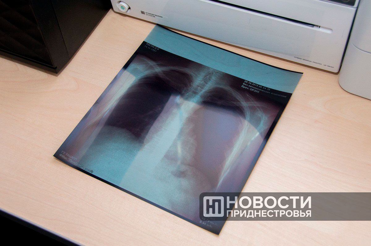 Более 14 тысяч пациентов стоят на учёте у онкологов в Приднестровье